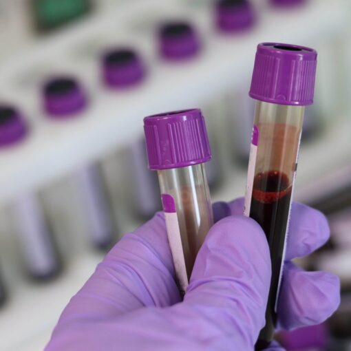 Lab Tests