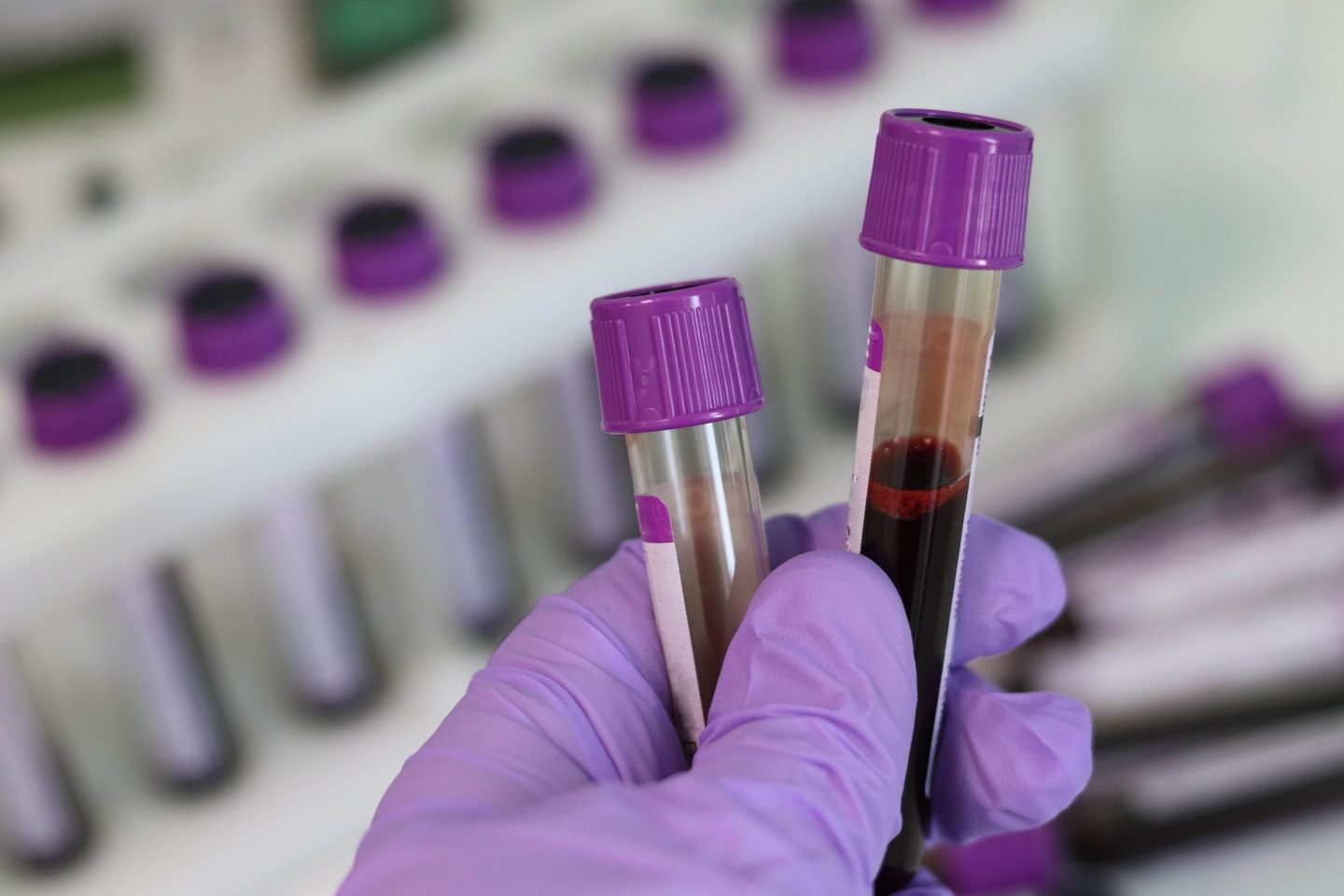Safe Sex, STIs, and Getting Tested – EP26