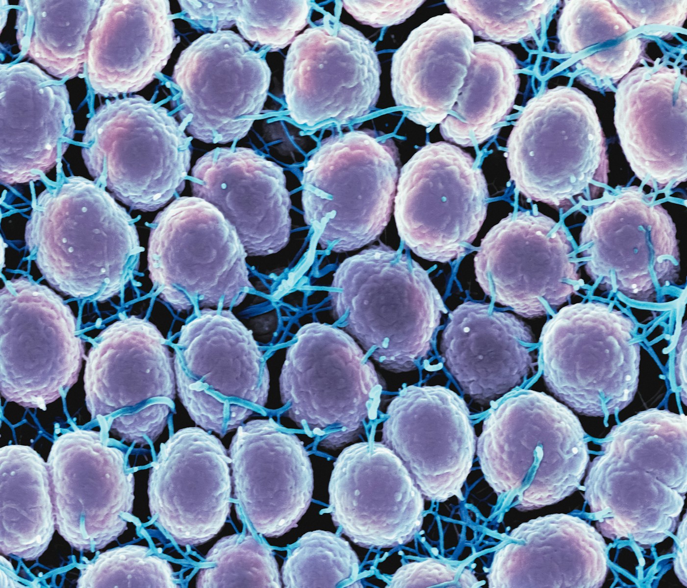 Most Common Swinger STI: Trichomoniasis
